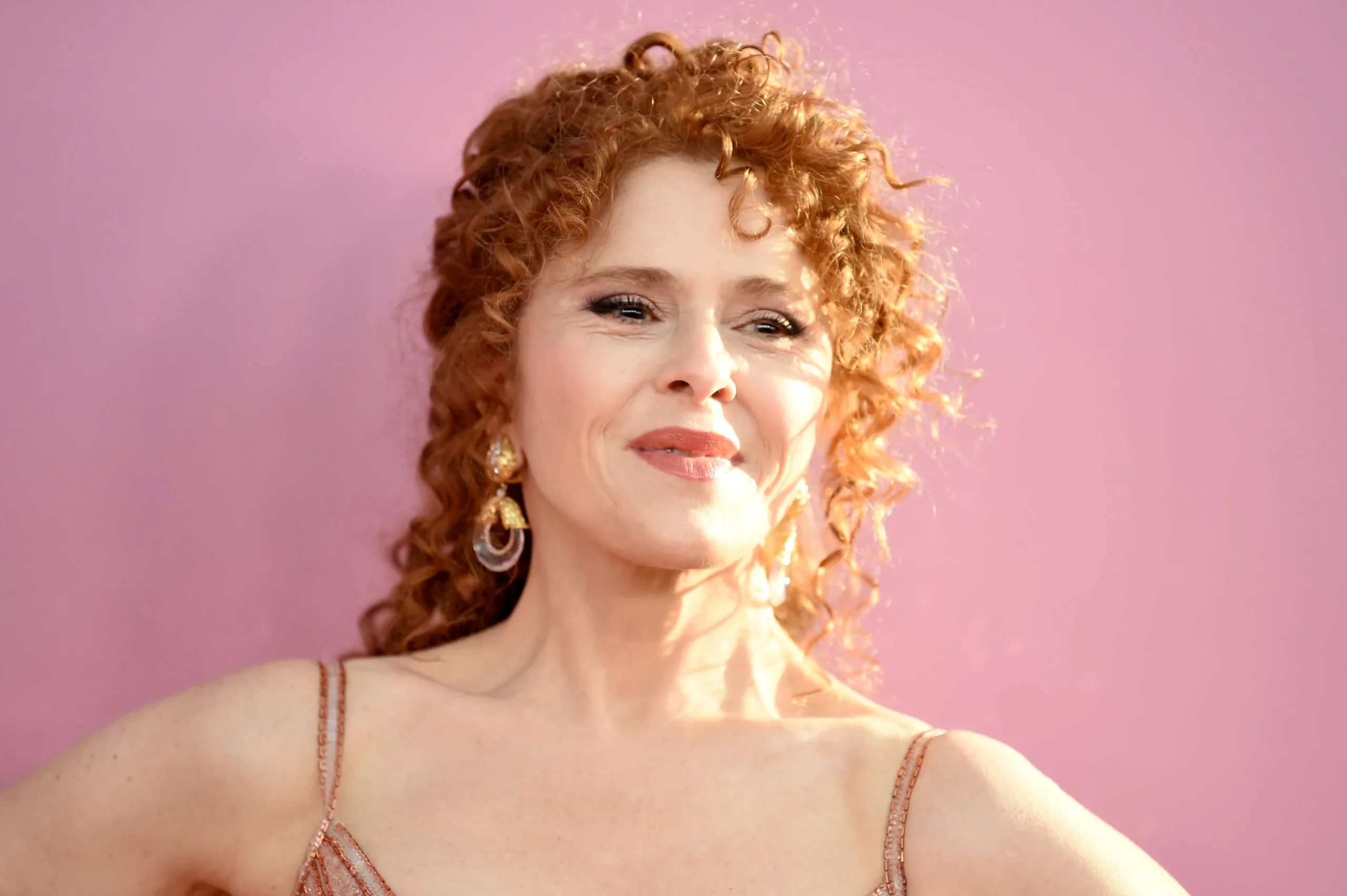 Bernadette Peters Plastic Surgery