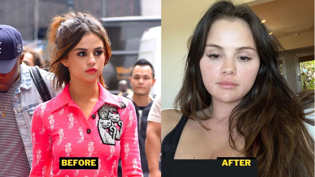 Selena Gomez Weight Gain