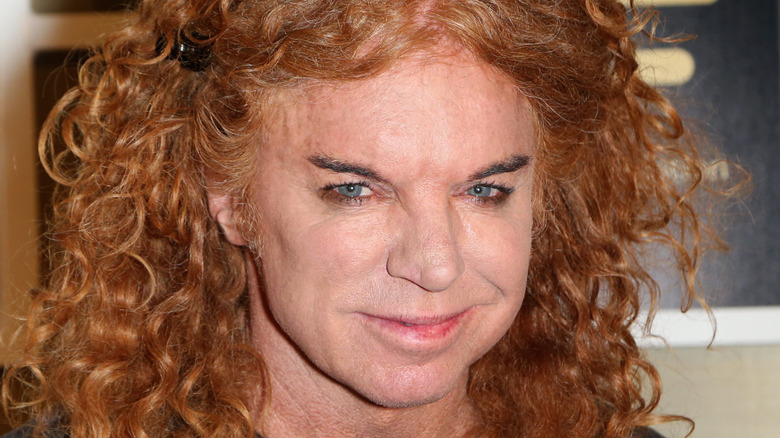 Carrot Top Plastic Surgery