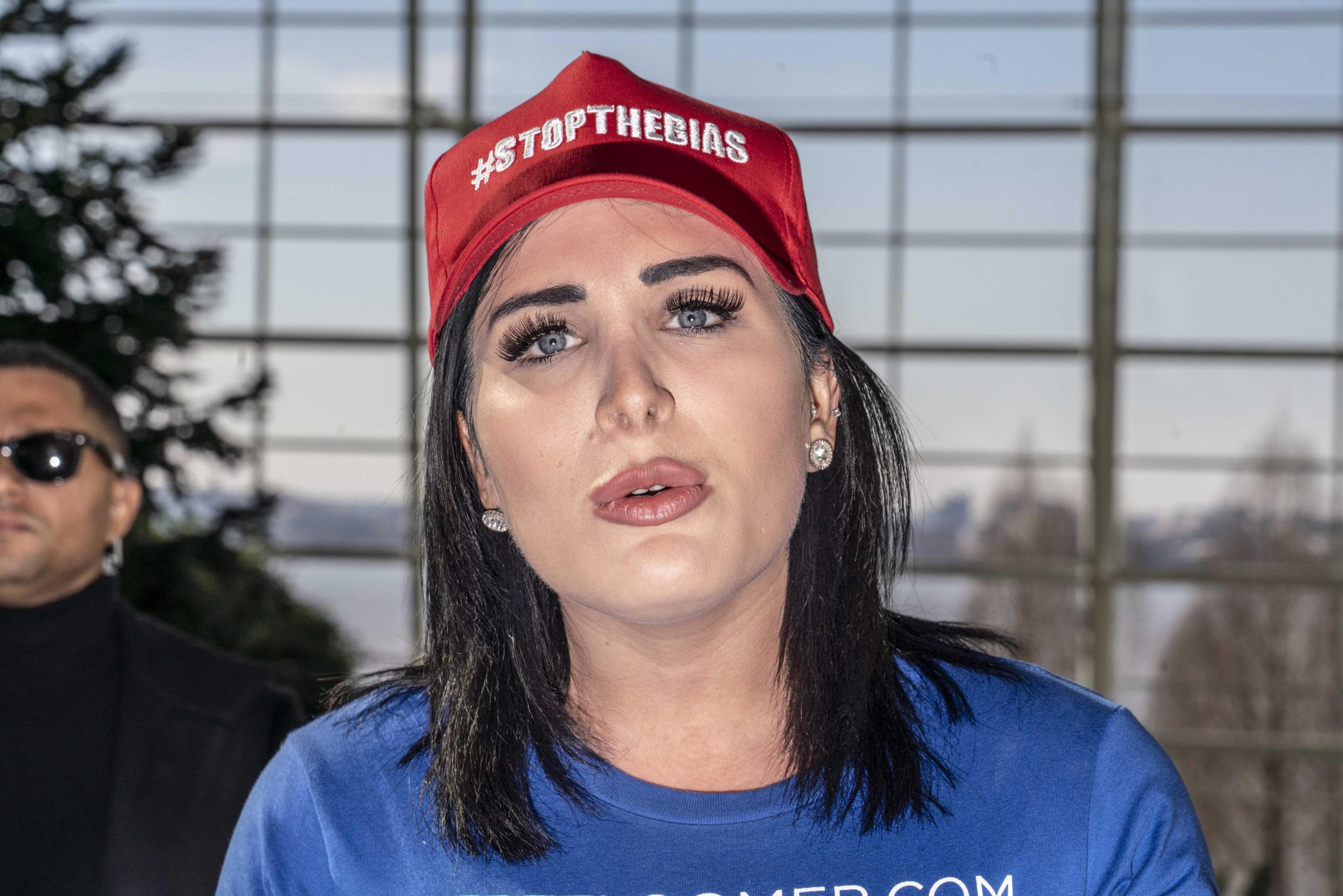 Laura Loomer Plastic Surgery