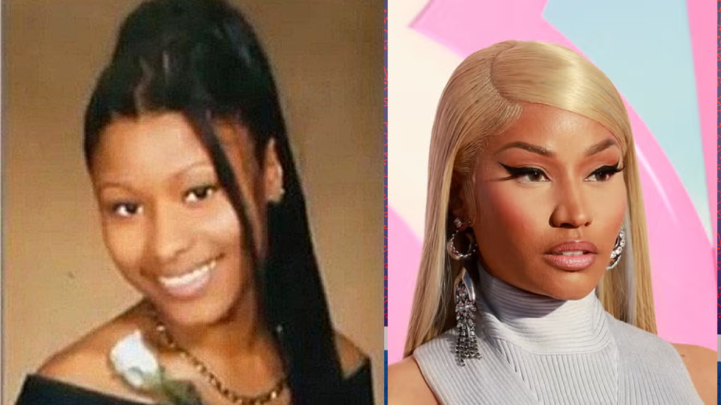 nicki minaj before and after