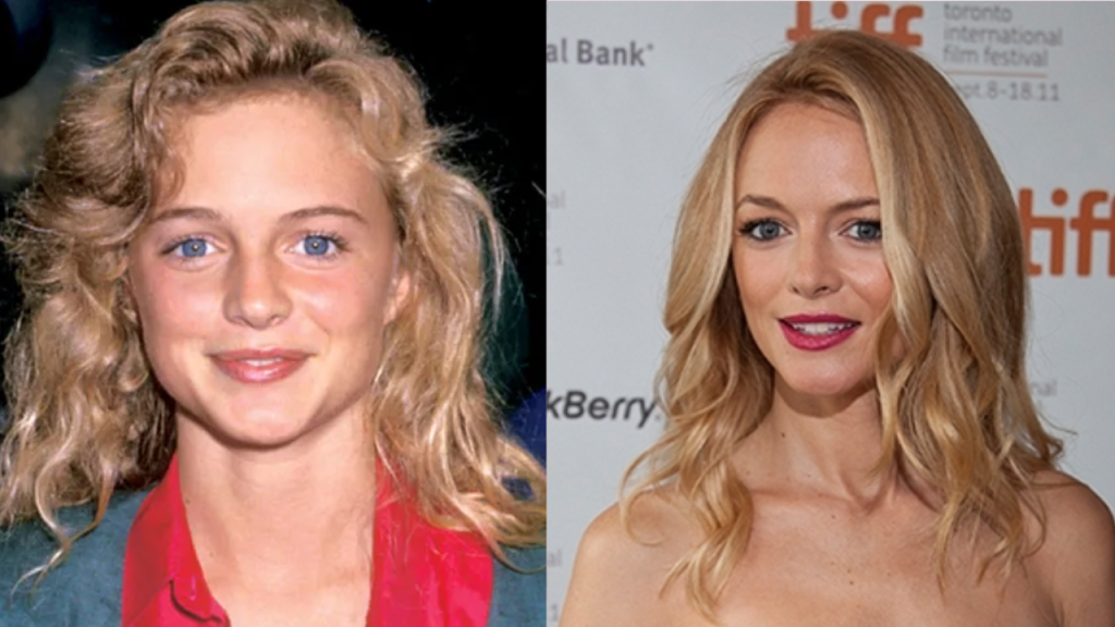 Heather Graham Plastic Surgery