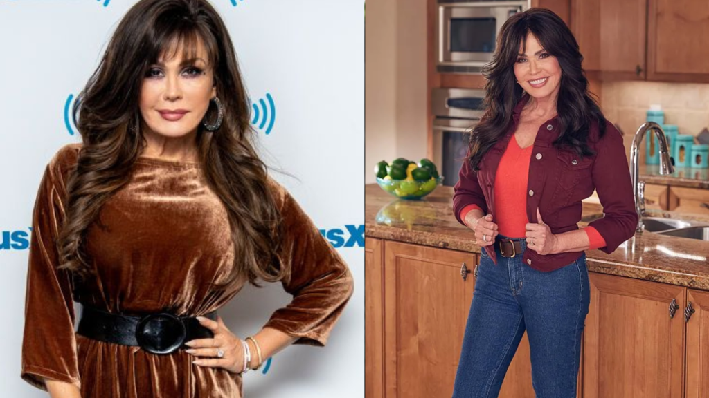 marie osmond had plastic surgery