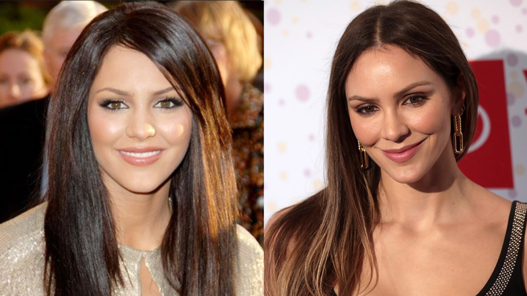 Katharine McPhee  Plastic Surgery
