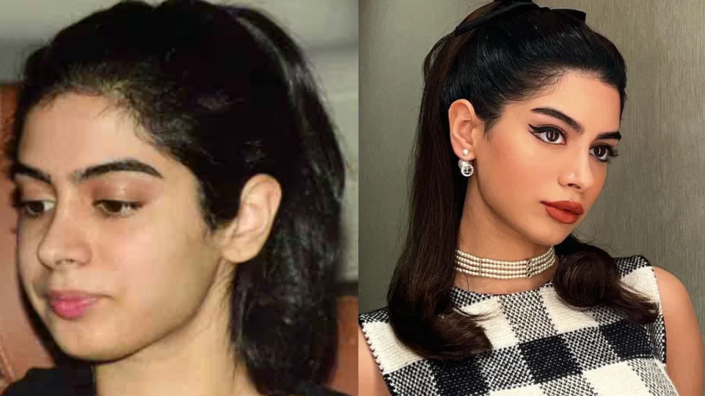 khushi kapoor plastic surgery