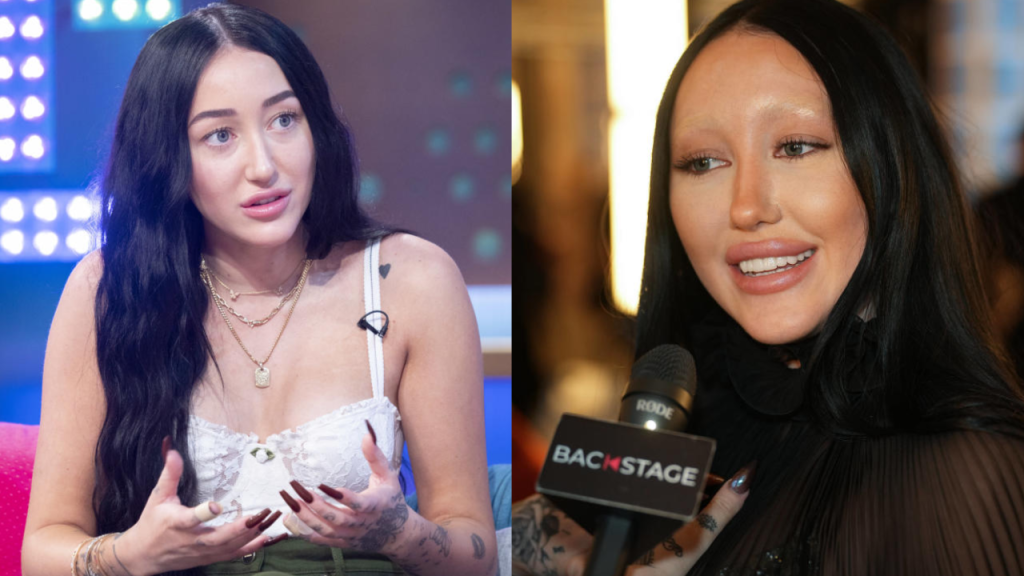 noah cyrus plastic surgery