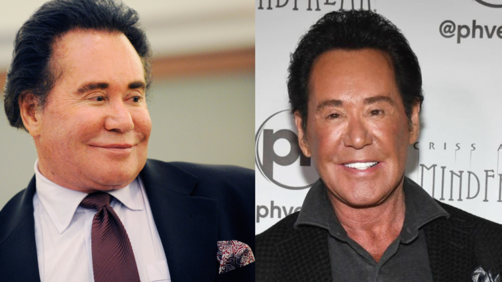 wayne newton plastic surgery