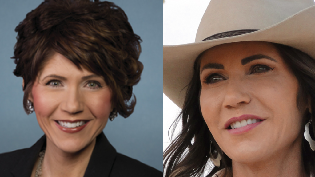 Kristi Noem Plastic Surgery