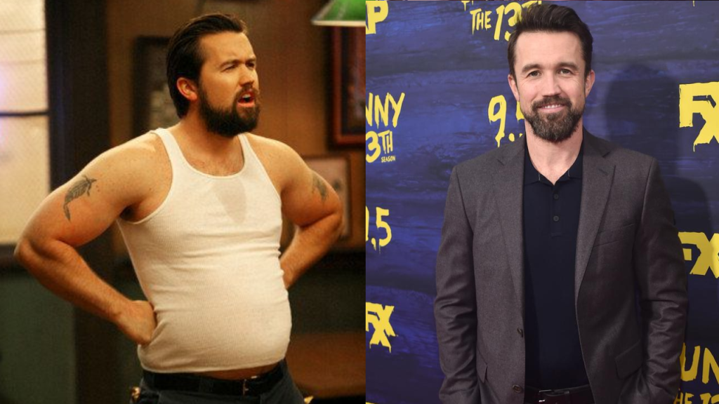 rob mcelhenney plastic surgery