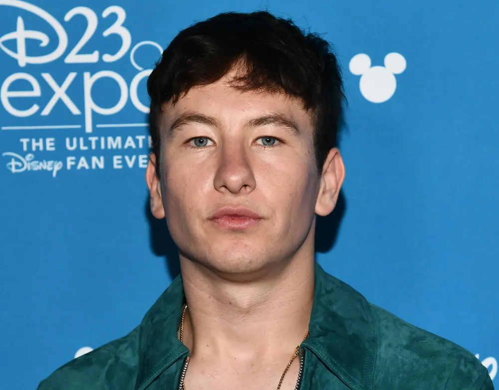 Barry Keoghan’s Plastic Surgery