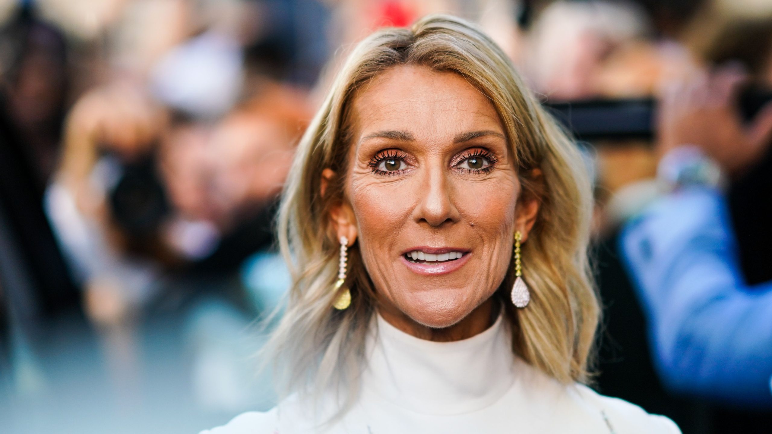 celine dion plastic surgery