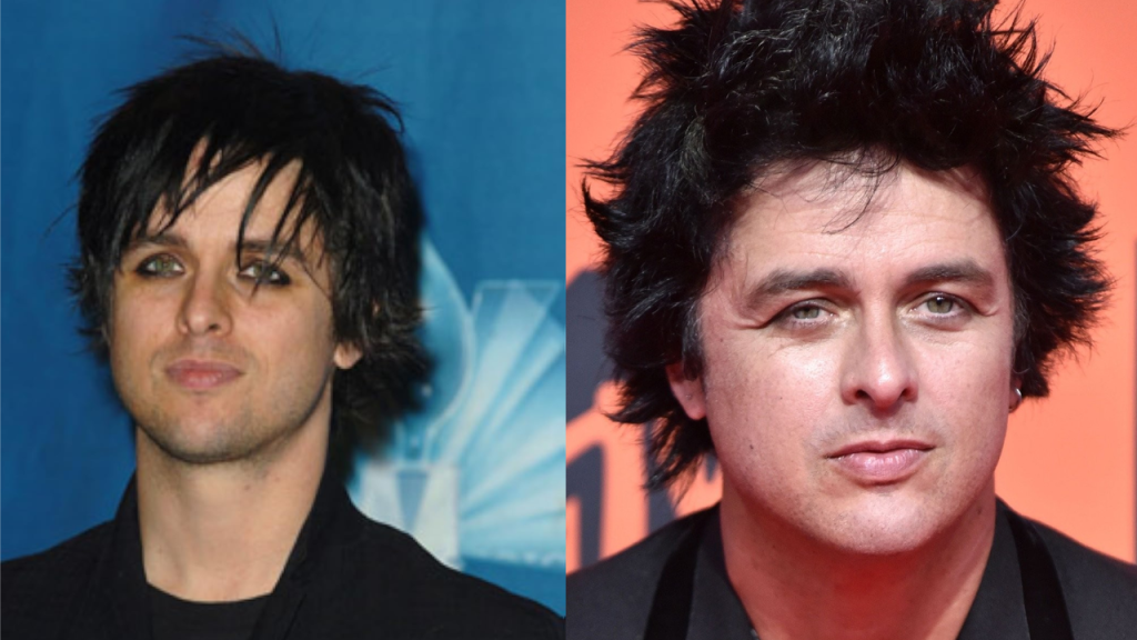 billie joe plastic surgery