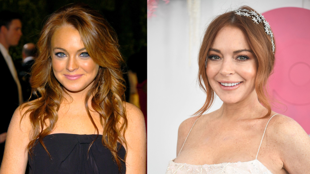 lindsay lohan plastic surgery