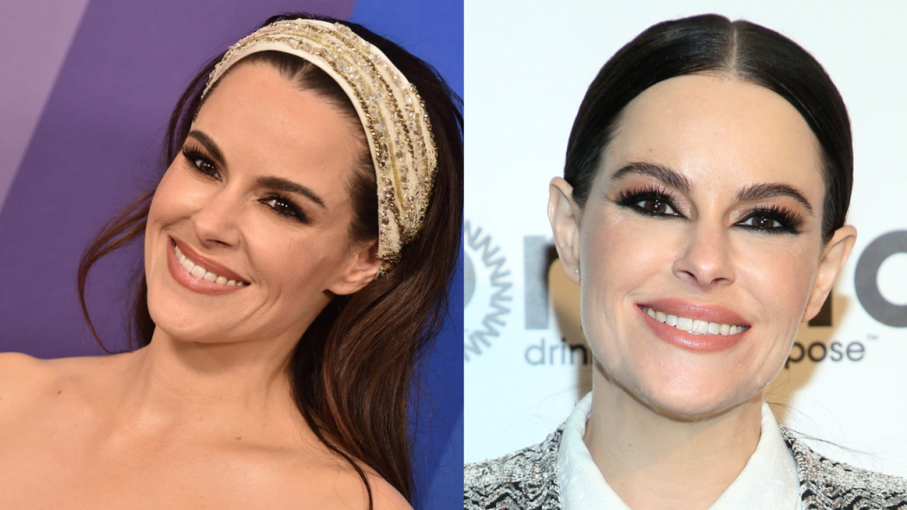 Emily Hampshire  plastic surgery