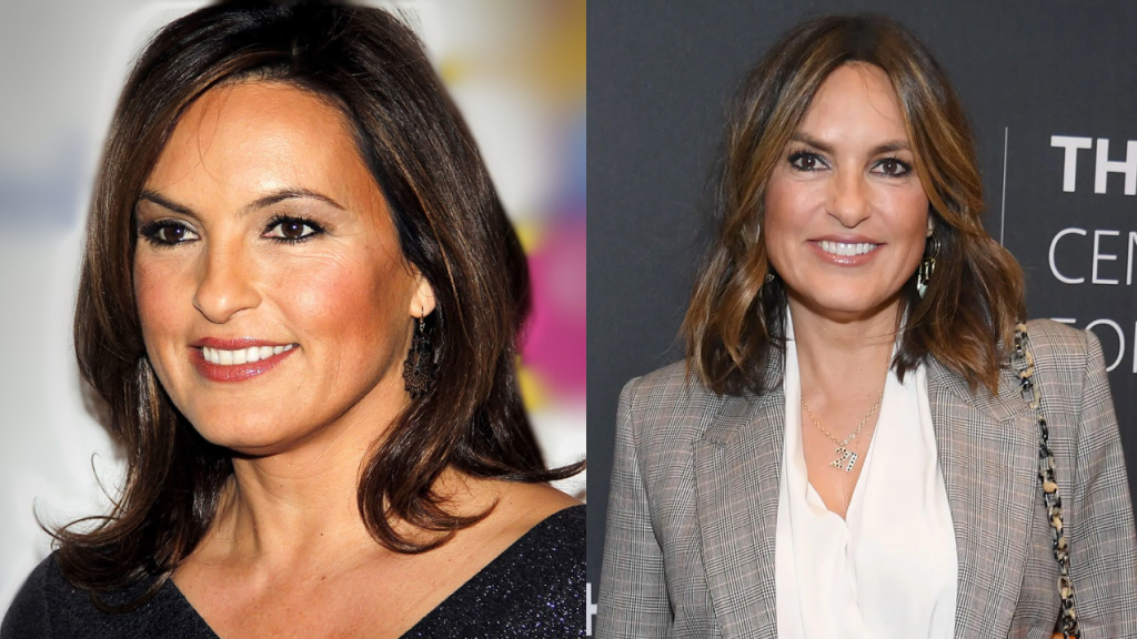 Mariska Hargitay Plastic Surgery