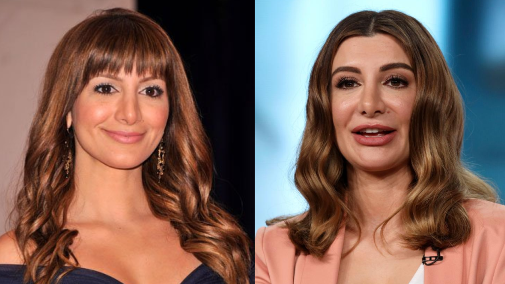 nasim pedrad plastic surgery