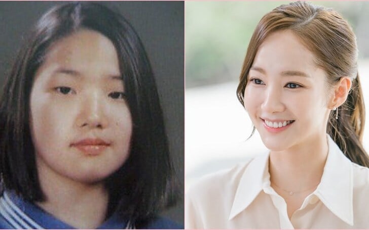 park min young plastic surgery