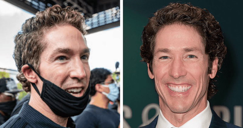 Joel Olsteen Plastic Surgery: Did Joel Osteen have surgery to change his appearance?