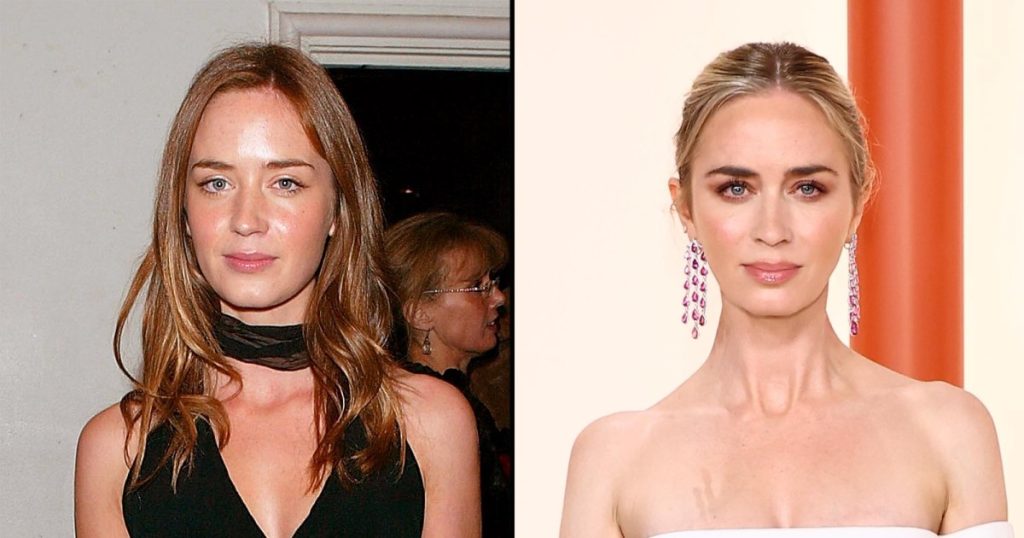 Emily Blunt Plastic Surgery: People are talking about whether Emily Blunt had plastic surgery.