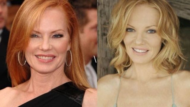 Marg Helgenberger Plastic Surgery: Has She Had Plastic Surgery?