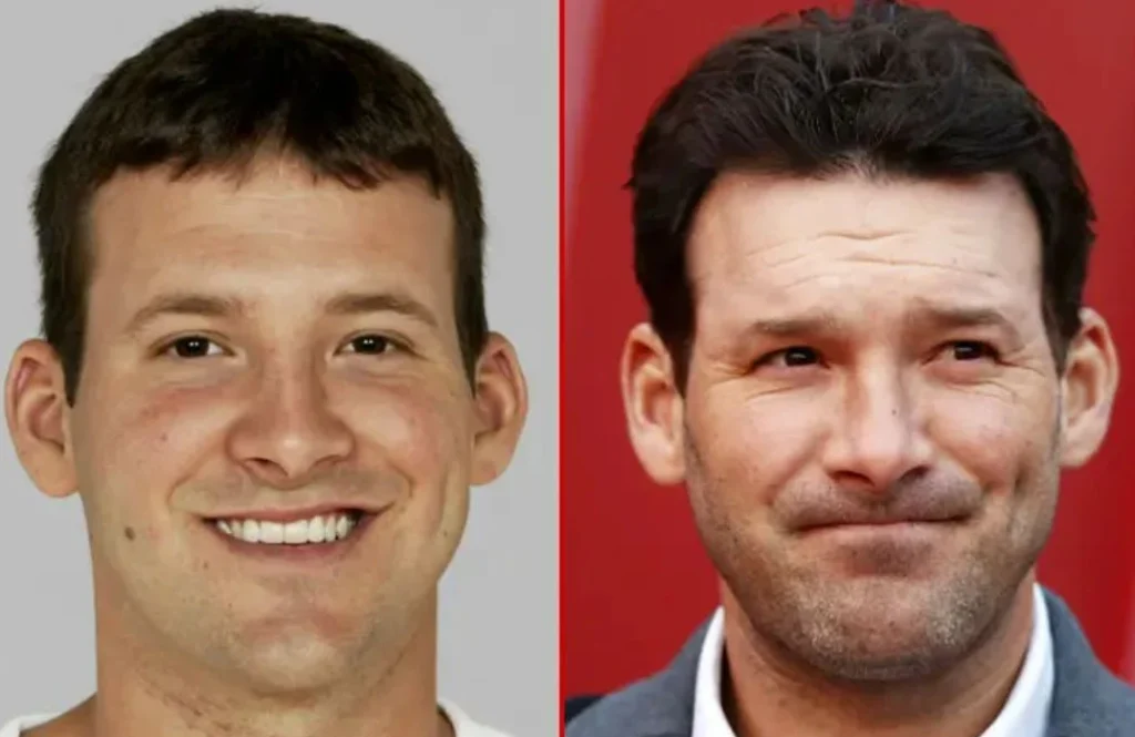 Tony Romo Plastic Surgery: Rumors and Truths About His Plastic Surgery.  