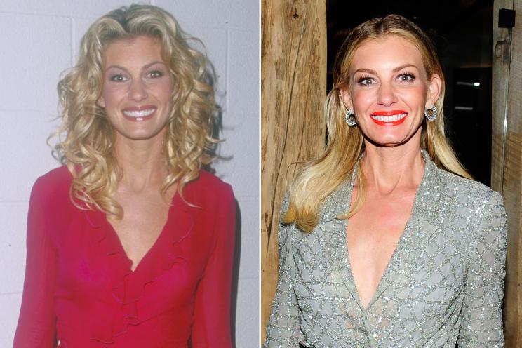 Faith Hill's Plastic Surgery: Has Faith Hill had plastic surgery?