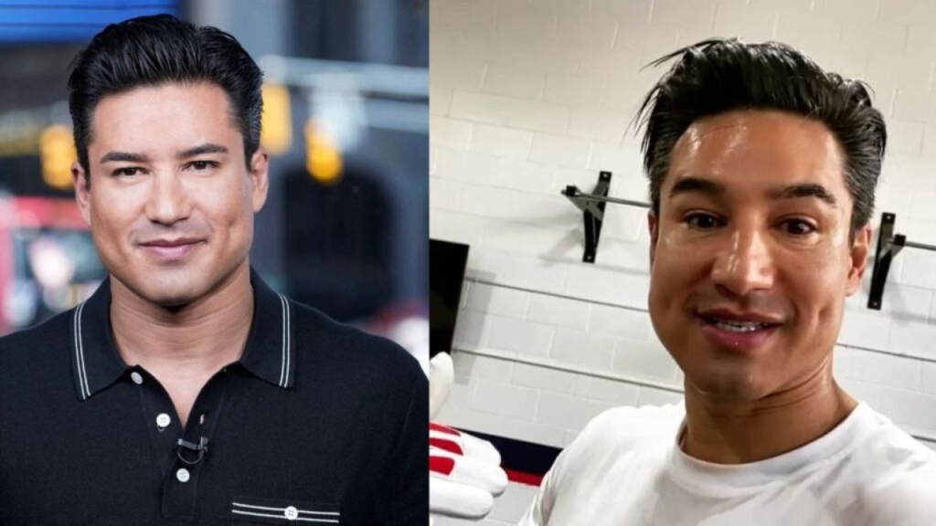 mario lopez plastic surgery