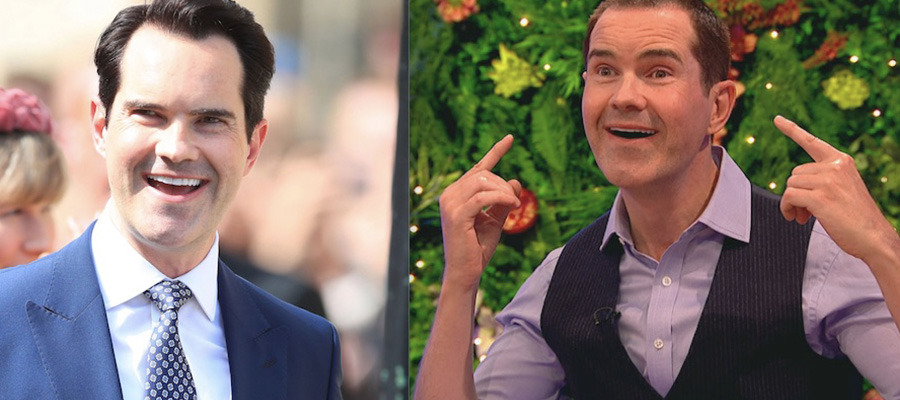 Jimmy Carr Plastic Surgery : Did Jimmy Carr have plastic surgery? 