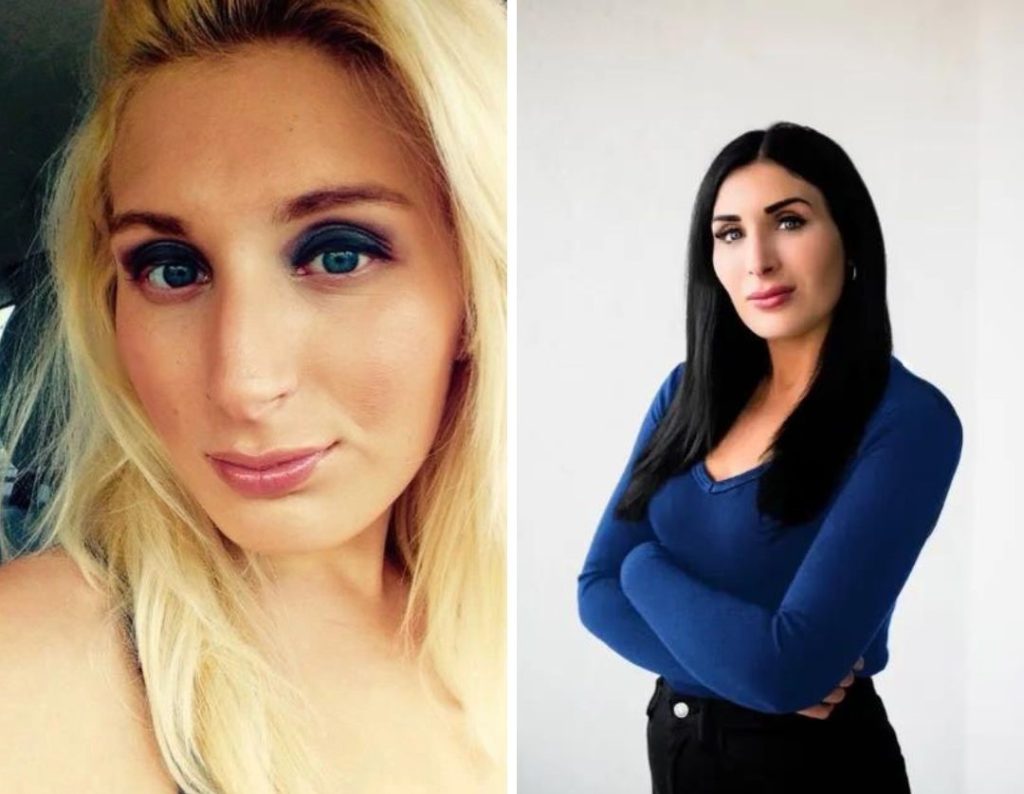 Laura Loomer Plastic Surgery: What Cosmetic Procedures Has She Undergone?