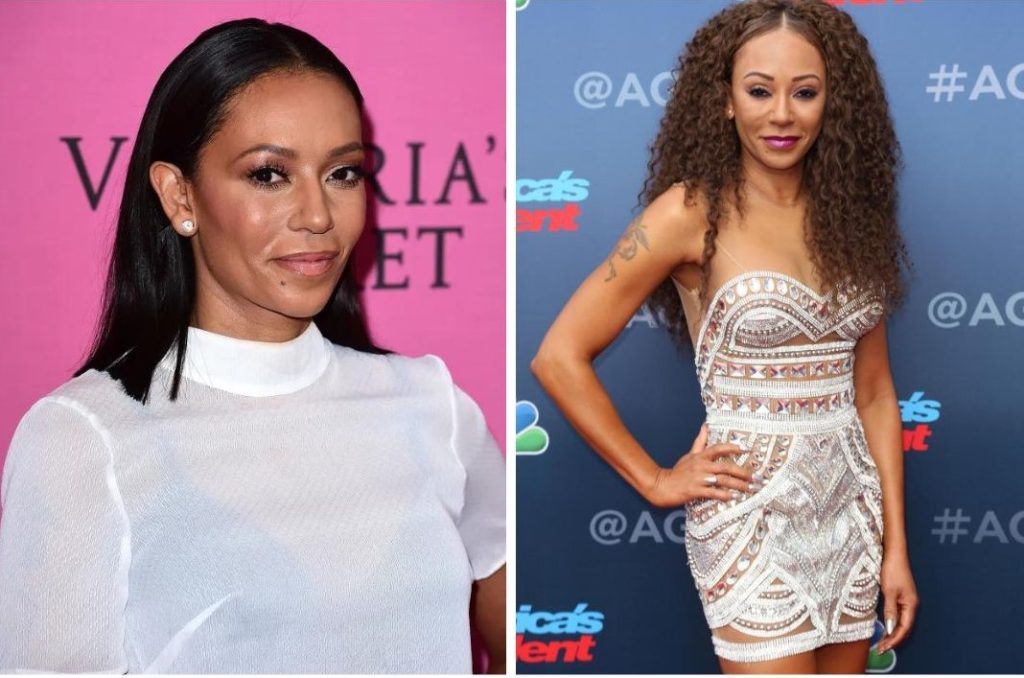 Mel B Plastic Surgery: Did She Get Surgery to Improve Her Looks?