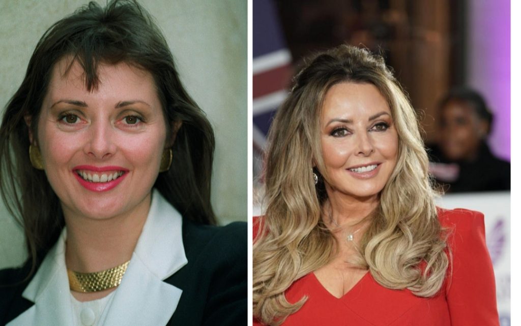 Carol Vorderman Plastic Surgery: She Get Little Things Done