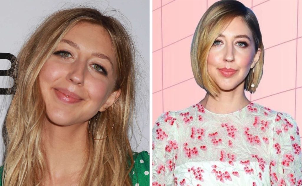 Heidi Gardner Plastic Surgery: What Happened to Her Face?