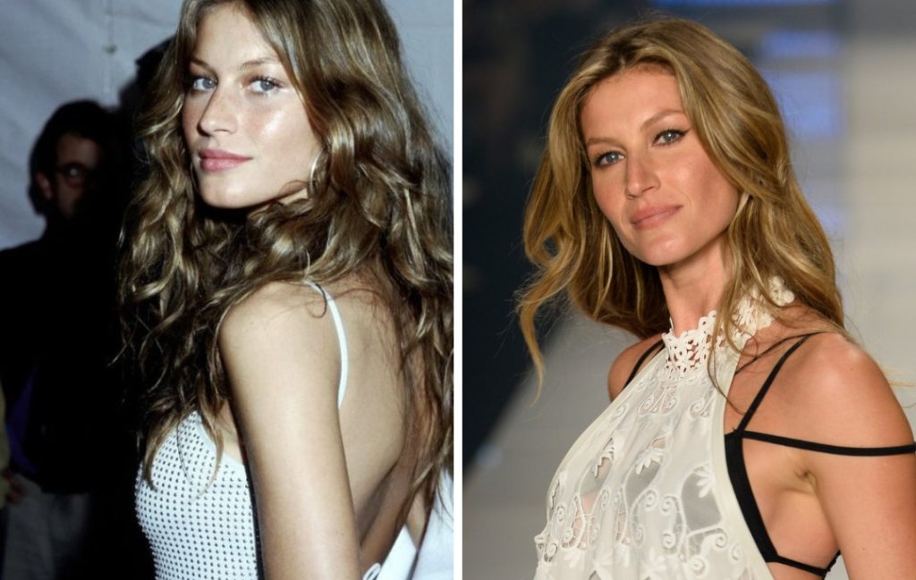 Gisele Bundchen's Plastic Surgery: Has She Had Plastic Surgery?