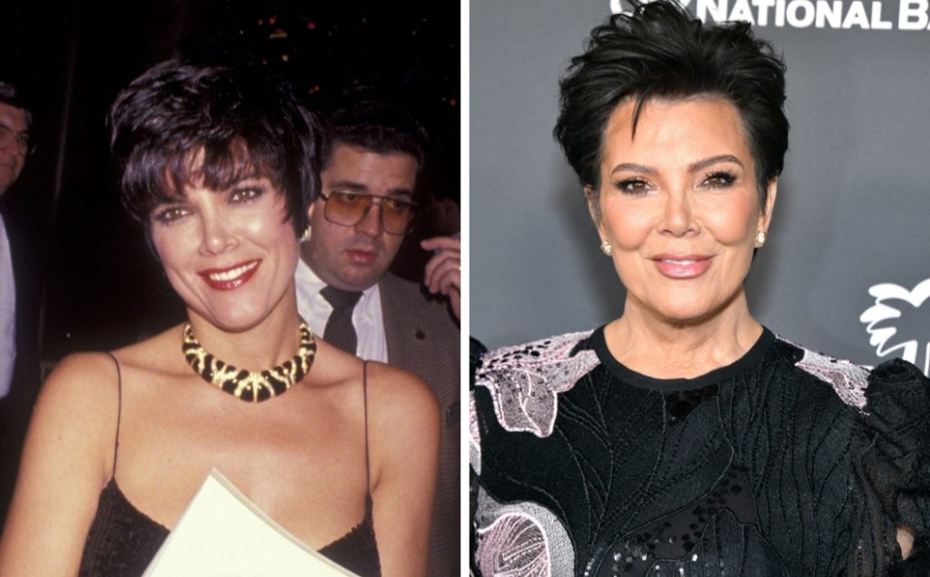 Kris Jenner Plastic Surgery: She Revealed Her Youthful Skin's Secret! 