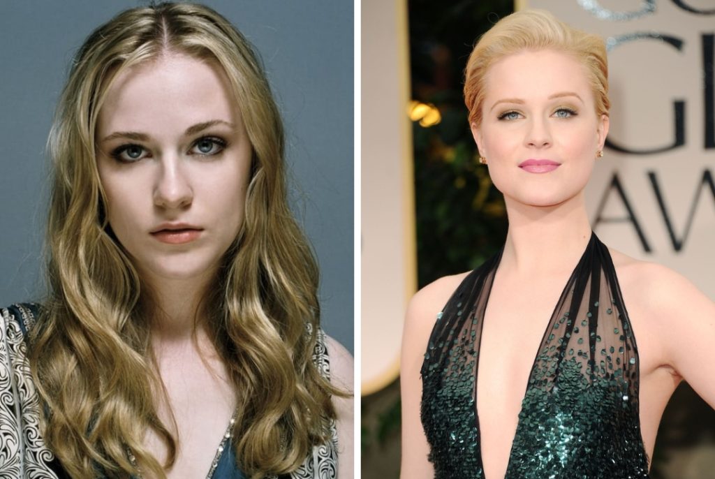 Evan Rachel Wood Plastic Surgery: Impact on Self-Image and Body Positivity