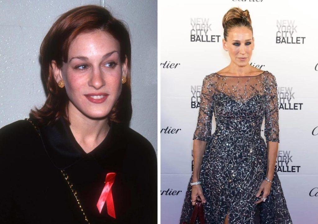 Sarah Jessica Parker Plastic Surgery: Has Her Appearance Changed Over Time?